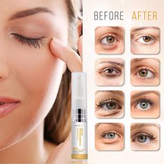 Eye Bags Makeup, Remove Eye Bags, Eye Wrinkles, Instant Face Lift, Under Eye Wrinkles, Bags Makeup, Dark Circles Under Eyes, Reduce Dark Circles, Eye Anti Aging