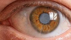 Does Medicare Insurance Cover Cataract Surgeries? - GoodRx Eye Surgeon, Lasik Surgery, How To Focus Better, Healthy Eyes, Eye Surgery, Eyes Problems, Human Eye, Eye Health, Eye Care