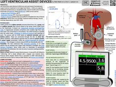 an image of a medical device with instructions on it