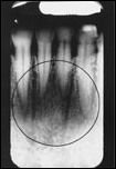 Dental Quizzes and flashcards. awesome Radiographic Anatomy, Registered Dental Hygienist, Dental Fun