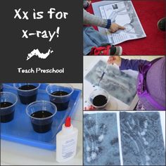 there are several pictures with different things in them and the words x is for x - ray