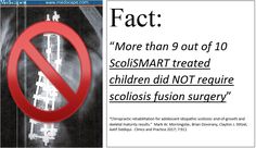 The ScoliSMART approach to treating scoliosis more effective at preventing fusion surgery than scoliosis braces. Scoliose Braces, Foraminal Stenosis, Communication Tools, Chiropractic, Surgery, Memes