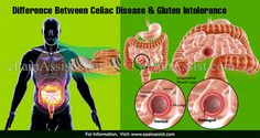 Difference Between Celiac Disease & Gluten Intolerance Small Intestine, Gluten Intolerance, The Immune System, Immune System, Disease, The Body