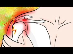 Pinched Shoulder Nerve Relief, Shoulder Pinched Nerve, Strained Shoulder Muscle Relief, Sprained Shoulder Remedies, Pinch Nerve In Shoulder Relief, How To Wrap Shoulder Injury, Fix Shoulder Impingement, Shoulder Stiffness Stretching Exercises, How To Stretch Your Shoulders