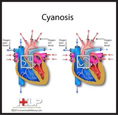 an image of the heart and its valves