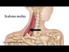 the neck and shoulder muscles are shown with an arrow pointing up to it's left side