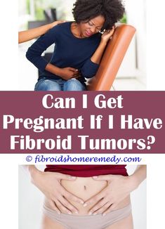 Uterine Fibroids Icd 10