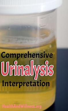 a close up of a jar of liquid on a table with the words comprehentive urinalysis interpretation