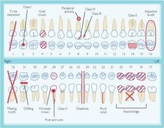 Dental+Charting+Form | Dental Humor | Pinterest | Dental, Dental for