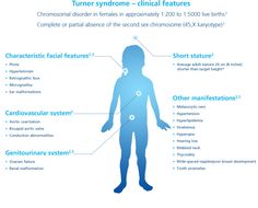 Turner Syndrome