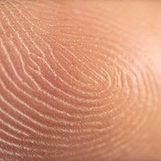 closeup of the skin on someone's arm with brown lines and circles in it