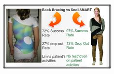 The ScoliSMART approach for treating scoliosis is better than bracing! Dr Berg, Dr J, Pelvic Pain, Success Rate, Effective Communication, Migraine, Communication Skills, Gut Health, Braces