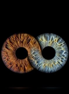 an eyeball with two different colored irises in the middle and one is brown