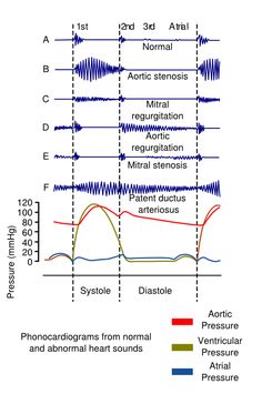 an image of the different types of sound waves and their corresponding amplitudes are shown in this