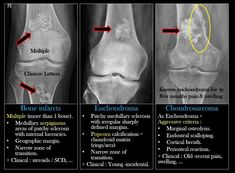 an x - ray shows the different stages of knee surgery and how they are performed