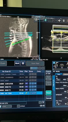 an x - ray image is shown on the monitor screen