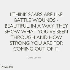 a quote that reads, i think scars are like battle wounds beautiful in way they show