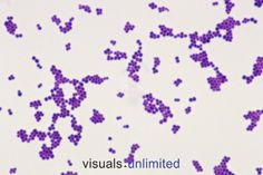 an image of purple dots on a white background with the words visuals unmixed