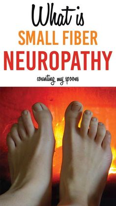 Small Fiber Neuropathy (SFN) is a condition where the small nerve fibers, responsible for sensations like pain and temperature, become damaged. This can lead to symptoms such as burning pain, tingling, and numbness, often in the hands and feet. Learn about its causes, symptoms, and treatment options to manage this condition effectively.