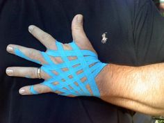 Inflammation, edema and and pain in hand and fingers #KinesiologyTapeCommunity #EdemaTreatment Kt Tape Jammed Finger, Kt Tape Wrist And Hand, Kinesiology Taping Hand, Kt Tape Wrist Support, Facet Arthropathy Exercise, Lymph Vessels