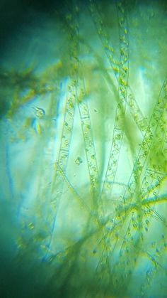 an image of some plants that are under the microscope lens, looking up at them