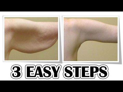 BAT WINGS, get rid of flabby triceps, loose skin, best arm workout for women! - YouTube Getting Rid Of Bats, Lose Arm Fat Workout, Arm Fat Workout, Arms Exercise, Stomach Toning, Lose Arm Fat Fast, Flabby Arm Workout, Bingo Wings, Stomach Toning Workouts