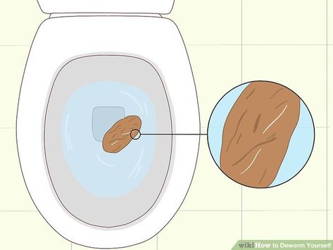 8 Ways to Deworm Yourself - wikiHow Parasite Cleanse Home Remedy, Human Deworming, Natural Human Dewormer, Human Parasites Pictures, Diy Dewormer For Humans, How To Get Rid Of Worms In Humans, How To Take Tumeric, How To Deworm Yourself Naturally, Pinworms Remedies