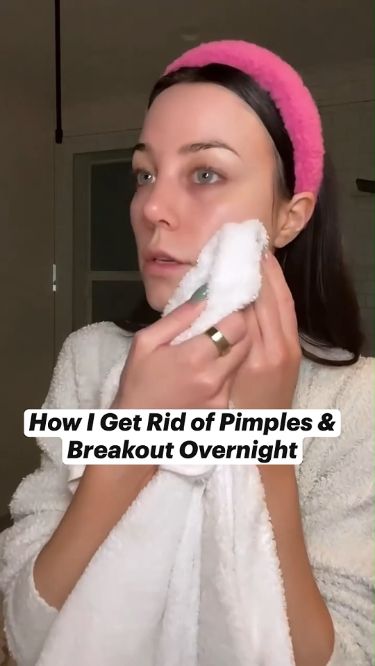 Pimple Pain Vanquished: Dermatologist-Approved Healing Tactics #beauty #beautyhacks #pimple #acne, #pimples #overnightpimples #removepimples #removepimplesovernight https://whispers-in-the-wind.com/combatting-pimples-under-the-skin-expert-tips-and-product-recommendations/?195 Overnight Pimple Remedies, Women Hygiene, Painful Pimple, Acne Prevention, Different Types Of Acne, Stubborn Acne, Clear Your Skin, Pimples Under The Skin, Fresh Aloe Vera Gel