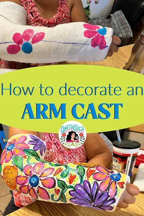 Cast Painting, Cast Designs Arm, Arm Cast Decorating Ideas, Leg Cast Decorating Ideas, Cast Drawing Ideas Arm, Decorating Casts Arm, Arm Cast Painting, Cast Decorating Ideas Leg, Cast Art Arm