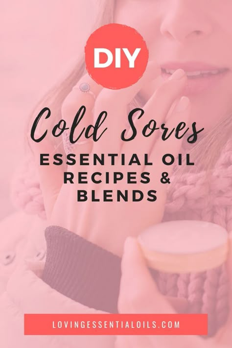 Essential Oils for Cold Sores on Lip with DIY Recipe Blends Essential Oil For Fever Blister On Lip, Doterra Cold Sore Remedy, Tea Tree Oil For Cold Sores, Essential Oil For Canker Sore In Mouth, Essential Oils For Cold Sores On Lip, Essential Oils For Fever Blister, Essential Oil For Cold Sore, Essential Oil For Cold Sore On Lip, Diy Cold Sore Remedy Fast