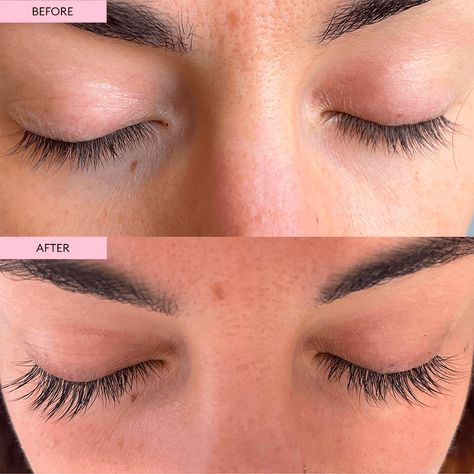 #Lash_Posts #Natural_Lash_Growth #Get_Long_Eyelashes #Natural_Eyelash_Growth Lash Serum Before And After, Lash Oil, Lash Posts, Get Long Eyelashes, Natural Eyelash Growth, Brow Growth Serum, Eyelashes And Eyebrows, Lash Growth Serum, Grow Lashes