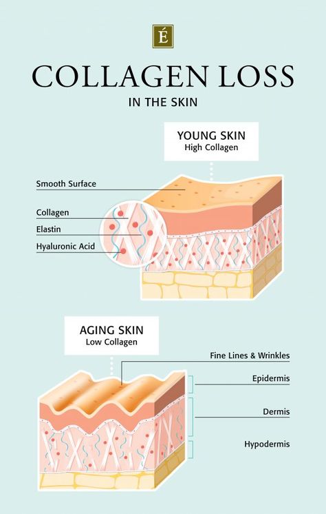 How To Make Your Skin Feel Stronger And Thicker | Skin facts, Collagen, Skin care business Skin Anatomy, Eminence Organic Skin Care, Skin Facts, Skin Moles, Skin Care Business, Skin Aesthetics, Collagen Benefits, Skin Science, Skin Collagen