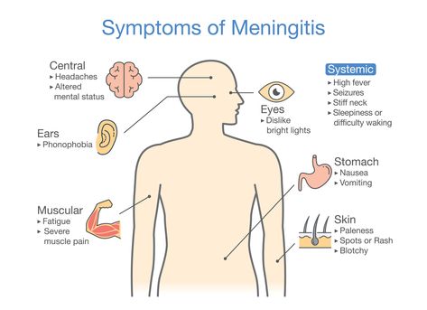 Community Medicine, Autoimmune Encephalitis, Fever Symptoms, The Human Anatomy, Neurological System, Ms Symptoms, Summer Study, Nerve Fiber, Multiple Sclerosis Awareness