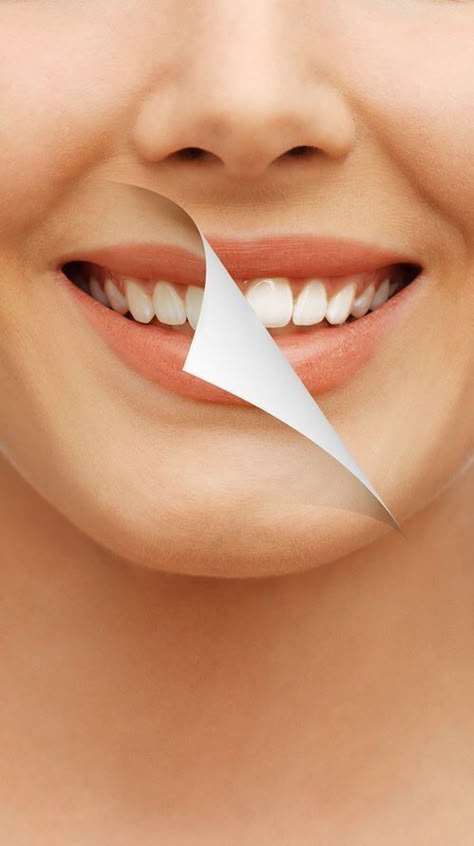 Teeth Whiteners, Dental Studio, Teeth Whitening Homemade, Teeth Whitening Diy, Whiten Teeth, Teeth Health, Dental Art, Natural Teeth Whitening, Natural Teeth