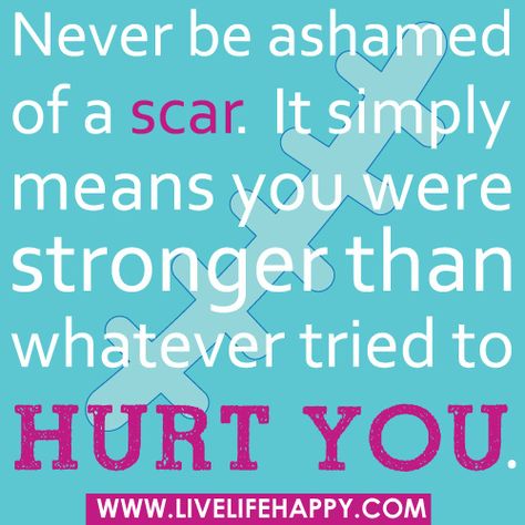 Never be ashamed of a scar. Chiari Malformation Awareness, Tattoo With Meaning, Cleft Lip And Palate, Cleft Lip, Live Life Happy, Chiari Malformation, Brain Surgery, You Are Strong, With Meaning