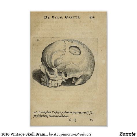 Embalming Room, Human Skull Anatomy, Anatomy Books, Anatomy Posters, Skeleton Vintage, Skull Anatomy, Brain Anatomy, Brain Surgery, Vintage Skull