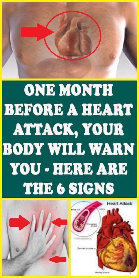 One Month Before a Heart Attack, Your Body Will Warn You – Here are the 6 Signs pinterest Congenital Heart Defect, Daily Health Tips, Shortness Of Breath, Good Health Tips, Health Advice, Health Facts, Heart Health, One Month, Warning Signs