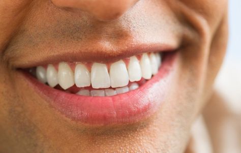 Toothpaste or gel? Strips or pens? 8 Teeth Whitening Products That Actually Work Best Teeth Whitening Products, Teeth Aesthetic, Pretty Teeth, Veneers Teeth, Teeth Whitening Remedies, Beautiful Teeth, Whitening Products, Human Teeth, Gap Teeth