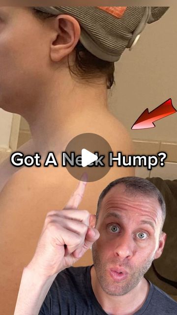 Stretch Upper Back And Neck, How To Get Rid Of Dowagers Hump, Exercises For Hump On Neck, Upper Back Hump, How To Get Rid Of Neck Hump Fast, Hump Neck Exercise, Dowagers Neck Exercises, Hump On Back Of Neck, Back Hump