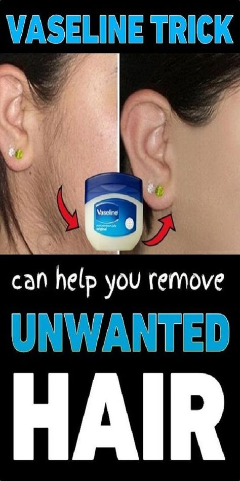 This Vaseline Trick Can Help You Remove Unwanted Hair Male Hair Removal, Unwanted Facial Hair Removal, Brazilian Hair Removal, Best Permanent Hair Removal, Permanent Hair Removal Cream, Permanent Facial Hair Removal, Chin Hair Removal, Upper Lip Hair Removal, Back Hair Removal