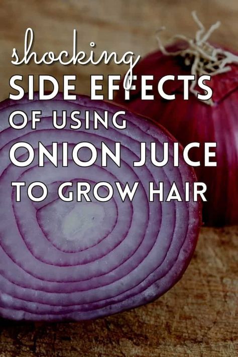 Hair Growth Onion Juice, Onion Remedy For Hair Growth, Juices For Hair Growth, Onion Oil Benefits, Onion And Aloe Vera For Hair Growth, Drinking Onion Water Benefits, Rosemary Onion Hair, Benefits Of Onion Water, Onion Oil For Hair Growth Diy