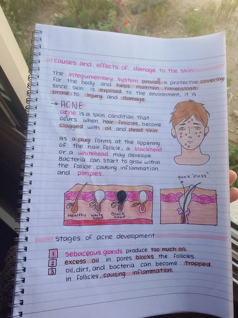 4.1 Integumentary, Skeletal, and Muscular System -Acne- paperlessplanning #digitalplannergoodnotestemplate #plannerdividersprintablefree #freeplannerinserts🍒


Source by claudiadabest Esthetics Study Notes, Dermatology Study Notes, Somatology Aesthetic, Cosmetology Study Notes, Dermatology Notes, Esthetician School Notes, Cosmology School, Anatomy And Physiology Notes Study, Revision Board