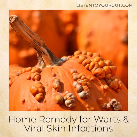 Warts may be passed from one person to another through skin contact. It is also possible to get warts by using objects previously touched by a person who has warts – like towels and gloves, etc. As with other viral infections, warts are highly contagious. As such, one can "self-spread" these lesions. Here is my Home Remedy Page for Warts & Viral Skin Infections... Home Remedy For Warts, What Causes Warts, Comfrey Salve, Home Remedies For Warts, Chronic Constipation, Colon Health, Oregano Oil, Viral Infection, Cold Sore