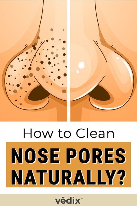 nose pores Clean Nose Pores, Nails Remedies, Diy Nail Care, Blind Pimple, Pimples Under The Skin, Nose Pores, Blackheads On Nose, Prevent Pimples, Weak Nails