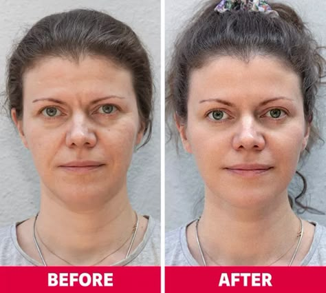 Yoga For Two, Face Lift Exercises, Facial Massage Routine, Face Yoga Exercises, Face Yoga Facial Exercises, Neck Exercises, Facial Yoga, Natural Lipstick, February Nails