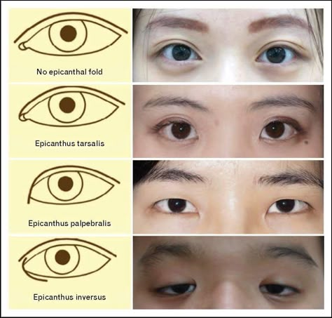 Epicanthic Fold, Draw Eyes, Drawing Eyes, Art Advice, Drawing Eye, Types Of Eyes, Human Anatomy Art, Face Drawing Reference, Anatomy Sketches