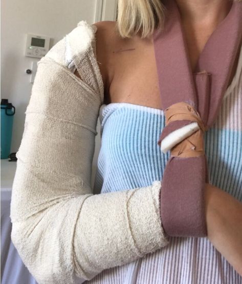 A Broken Humerus — Road to Recovery – Maddie Wirthman – Medium Fractured Shoulder, Arm Excersises, Injury Aesthetic, Character Characteristics, Fractured Arm, Humerus Fracture, Elbow Surgery, Oc Aesthetic, Bone Fracture