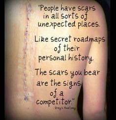 My scars Spinal Fusion Quotes, Spinal Fusion, Spinal Surgery, Grey Quotes, Road Maps, Grey's Anatomy Quotes, Anatomy Quote, Personal History, Grey's Anatomy