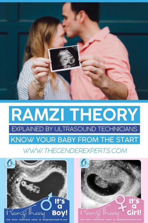 Baby Heart Rate Gender Prediction, Sonogram Gender Prediction, Baby Heartbeat Gender Prediction, Ramsey Theory Baby Gender, 6weeks Pregnant Ultrasound, 8weeks Pregnant Ultrasound, Week 6 Of Pregnancy, Anterior Placenta Gender Prediction, Fetal Heart Rate Gender