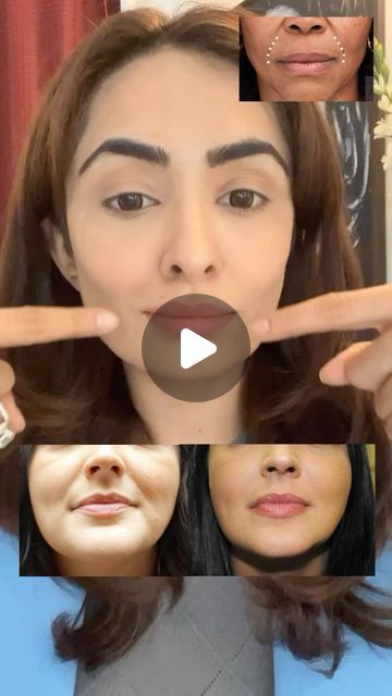 Face Reduce Exercise, Smile Line Exercises, Best Face Yoga Exercises, Morning Face Yoga, Face Yoga For Smile Lines, Face Excercise Smile Lines, Mimika Face Yoga, How To Reduce Smile Lines, Face Exercises For Wrinkles